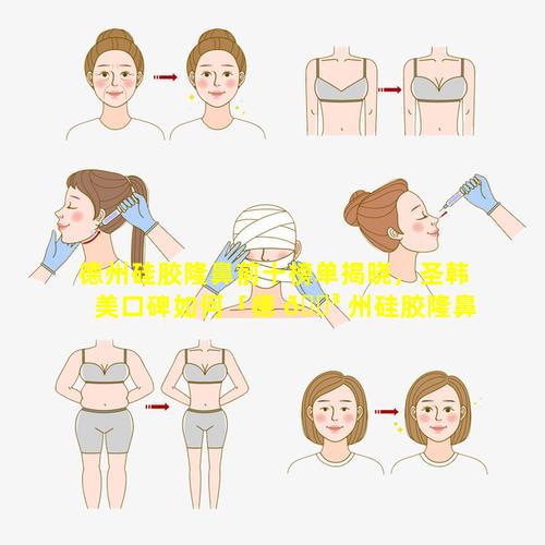 德州硅胶隆鼻前十榜单揭晓，圣韩美口碑如何「德 🐳 州硅胶隆鼻前十榜单揭晓,圣韩美口碑如何」